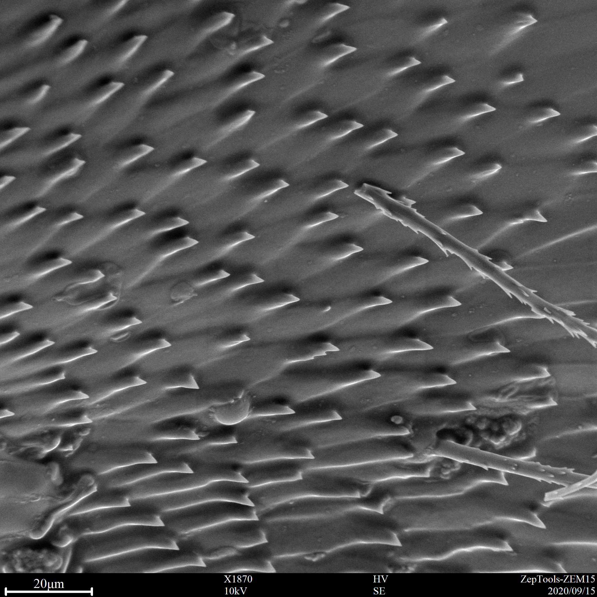 臺式掃描電鏡下生物樣品(會議現(xiàn)場拍攝) 臺式掃描電鏡下生物樣品(會議現(xiàn)場拍攝)